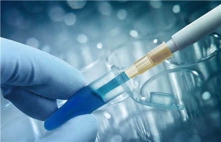 Restriction Site Associated DNA Sequencing (RAD-Seq)