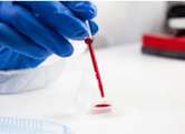 Immuno-profiling