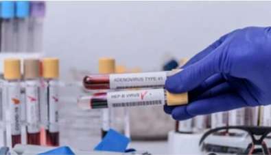 AAV Sequencing