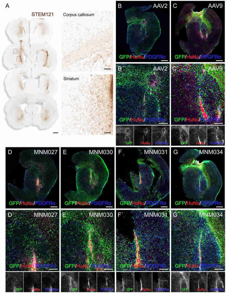 Validation of capsid variants ex vivo was carried out at D10 post - transduction (Giacomoni et al., 2024)