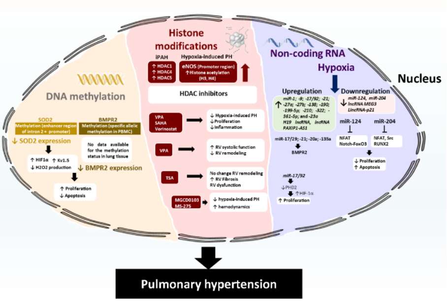 Illustration of epigenetic mechanisms in pulmonary hypertension (Bisserier et al., 2020)