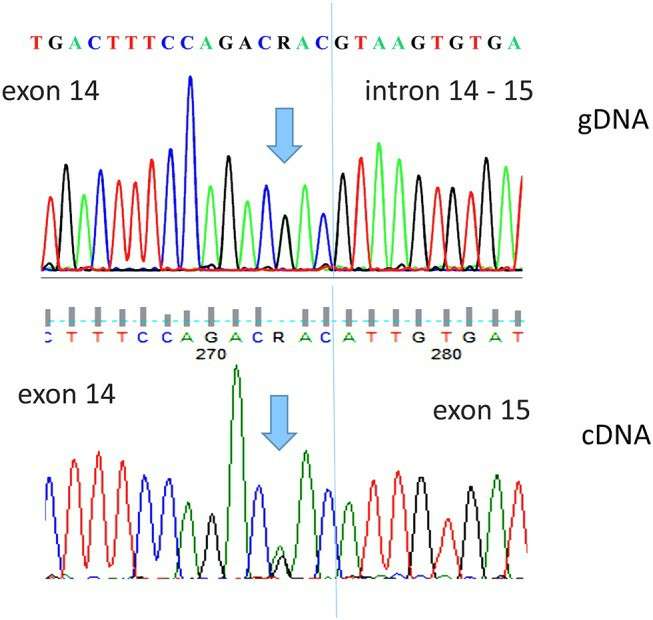 The DPYD c.1903A G, p.Asn635Asp variant was analyzed by direct sequence analysis (Palmirotta et al., 2019)