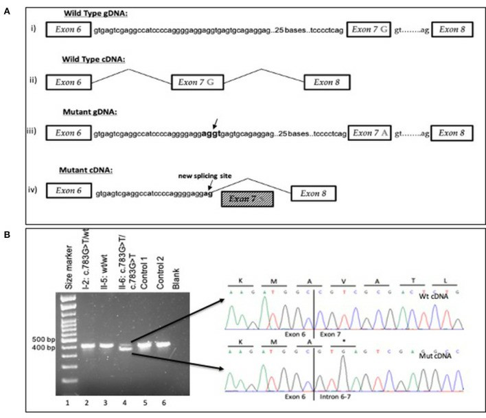 A schematic overview presenting the wild-type and mutant gDNA as well as cDNA of exons 6-8 in the ARPC1B gene (Papadatou et al., 2021)