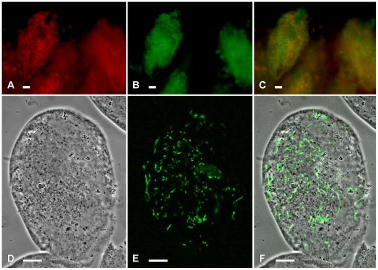 Fluorescence in situ hybridizations were carried out on Spirostomum sp. 72 and Euplotes octocarinatus FL(12)-VI (Schrallhammer et al., 2013)