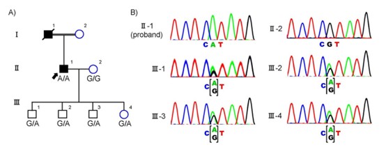 Figure 3. Pedigree diagram showing genetic analysis of a consanguineous family with inherited retinitis pigmentosa. ( Saito, 2021)