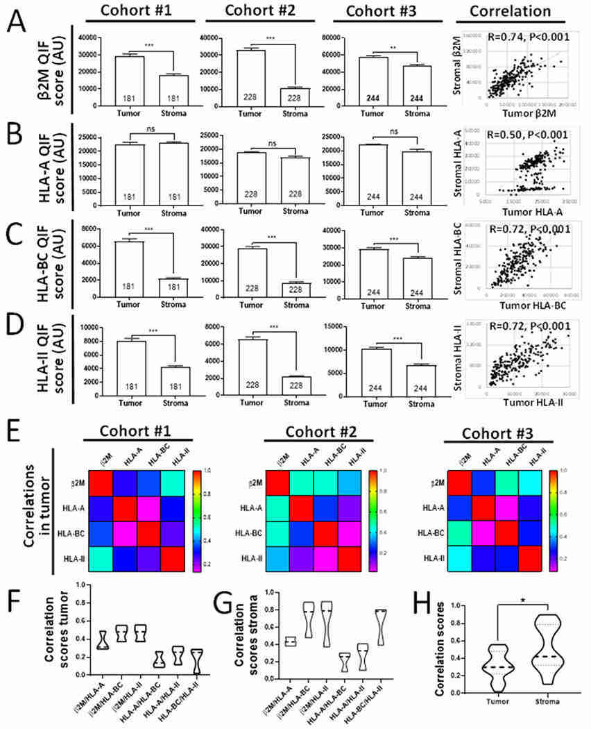 Cancer- and stromal cell-specific distribution patterns and interrelationships of HLA class-I and HLA class-II subunits in NSCLC (Datar et al., 2021)