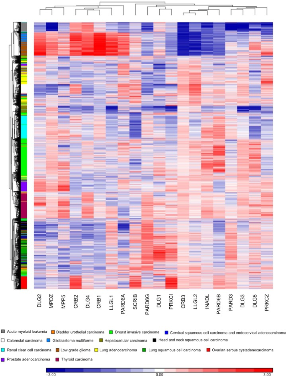 Bioinformatics methods are used to analyze the expression profile of polarity complex genes in human cancer.