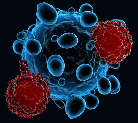 Glioma Gene Panel Sequencing