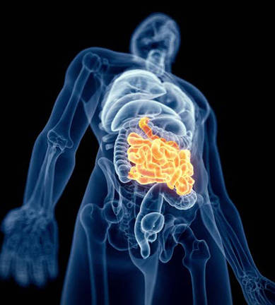Custom Inflammatory Bowel Disease Panel