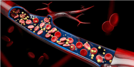 Custom Familial Hypercholesterolemia Panel
