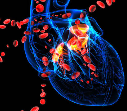 Custom Comprehensive Cardiomyopathy Panel