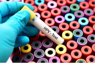 HPV Nucleic Acid Test Quality Control Products