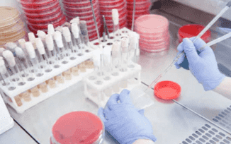 MassArray for Genotyping: Introduction, Advantages, and Applications in Pathogen Detection
