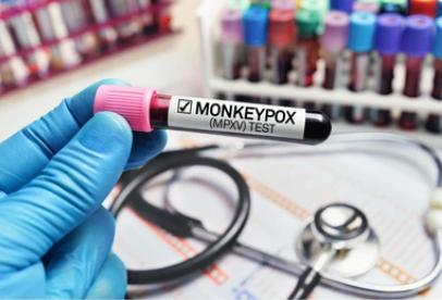 Monkeypox Pseudovirus Reference Products