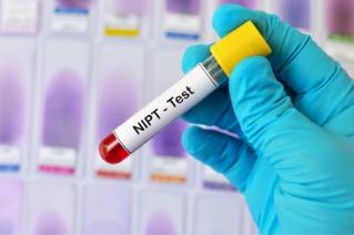 Non-Invasive Prenatal Testing NIPT Reference Products