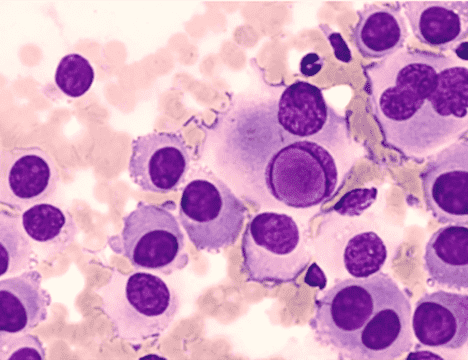 Solid Tumor Whole Genome Sequencing 