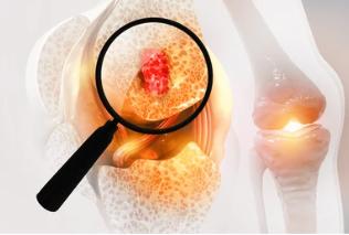 Tumor Mutation Burden TMB Reference Products