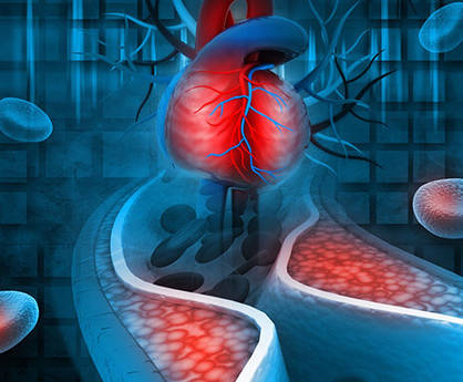 Custom Arrhythmia Panel