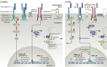 Custom Arrhythmogenic Cardiomyopathy Panel