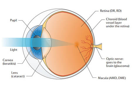 Custom Macular Degeneration Panel