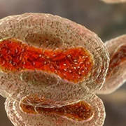 Monkeypox Virus Detection