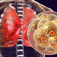 Respiratory Pathogen Detection