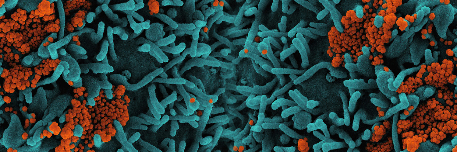Pathogen Detection Kits