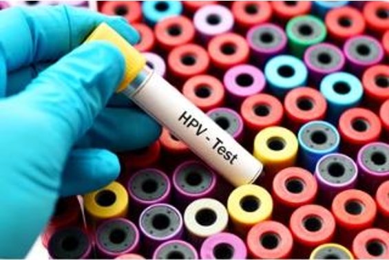 Controls and Reference Materials for Infectious Diseases and Pathogenic Microorganisms