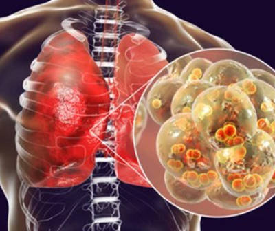 Respiratory Pathogen Panel Products