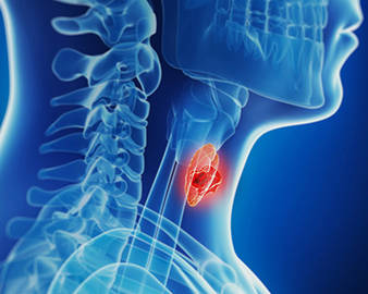 Thyroid Carcinoma Panel Sequencing