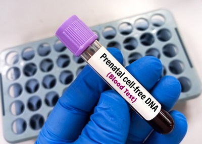 Epigenomic Data Analysis