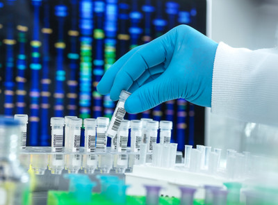 Genome-wide DNA Methylation Analysis Service