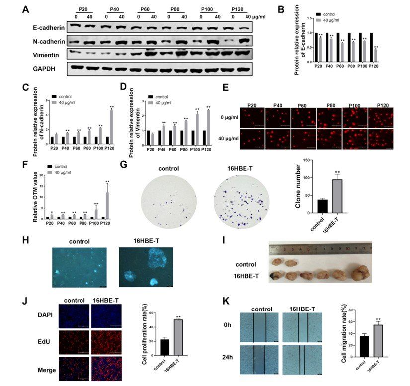 The malignant transformation of human bronchial epithelial cells caused by exposure to CBNPs (Zhang et al., 2024)