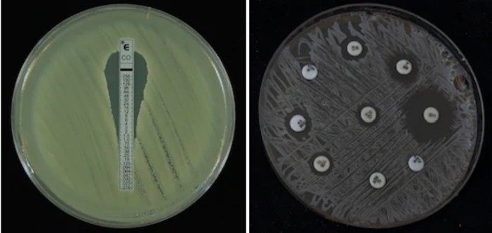 Antibiotic Resistance Testing Services