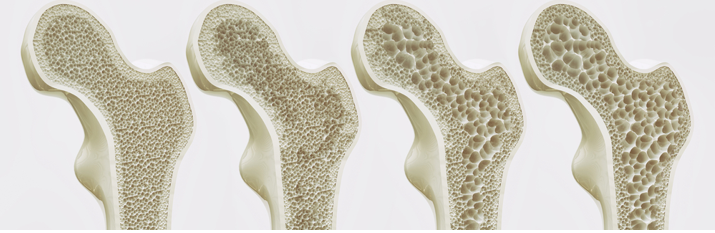 Gut Microbiota-Bone Axis Research