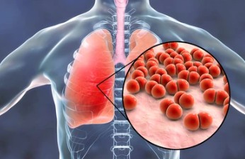 Long Read Sequencing for Infectious Disease Research