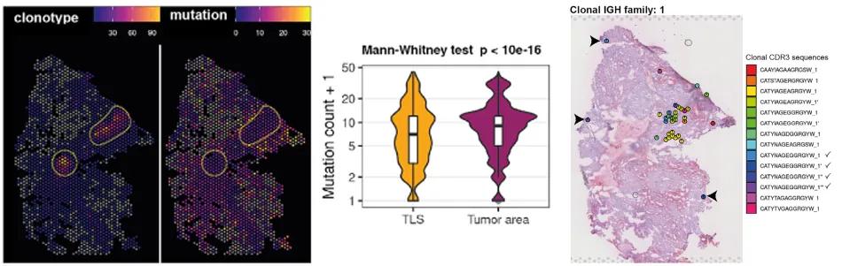 Figure 3. Spatial distribution and mutation frequency of BCR clonotypes in TLS regions, showing immune cell localization and variability.