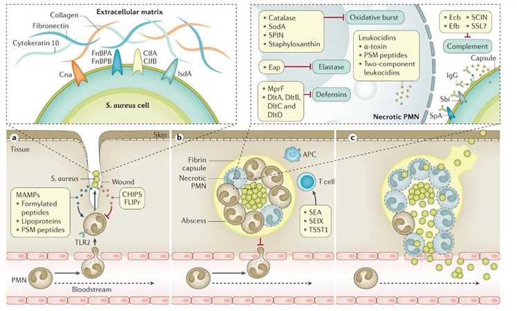 Stages of Staphylococcus aureus infection.