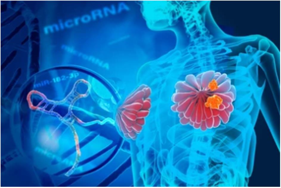 Transcriptome Analysis of Human Breast Cancer Cell Lines MCF-7