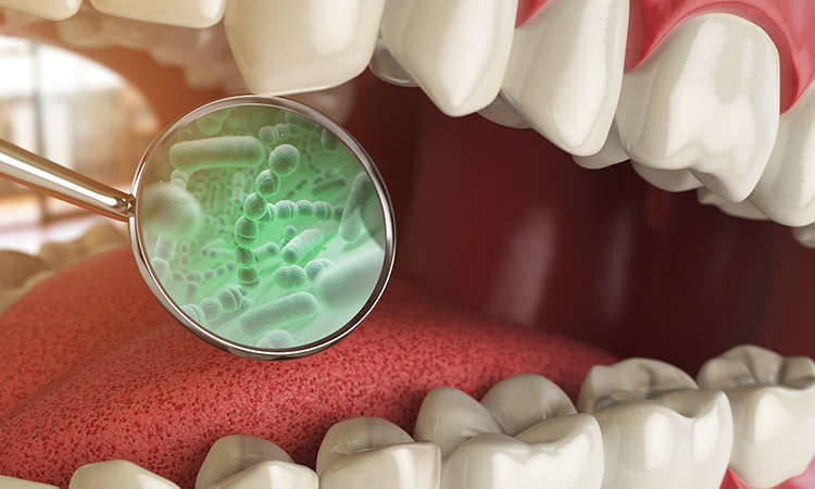 oral microbiota