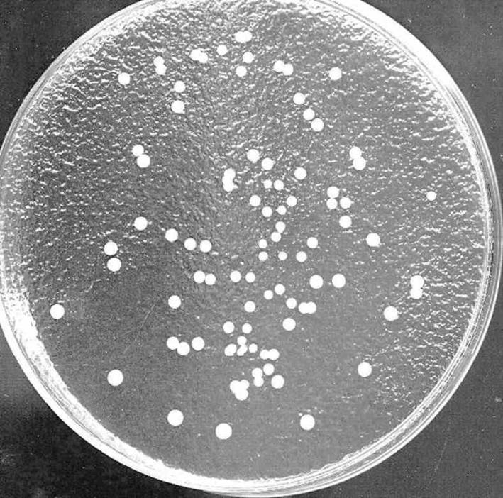 What Is Bacterial Colonies