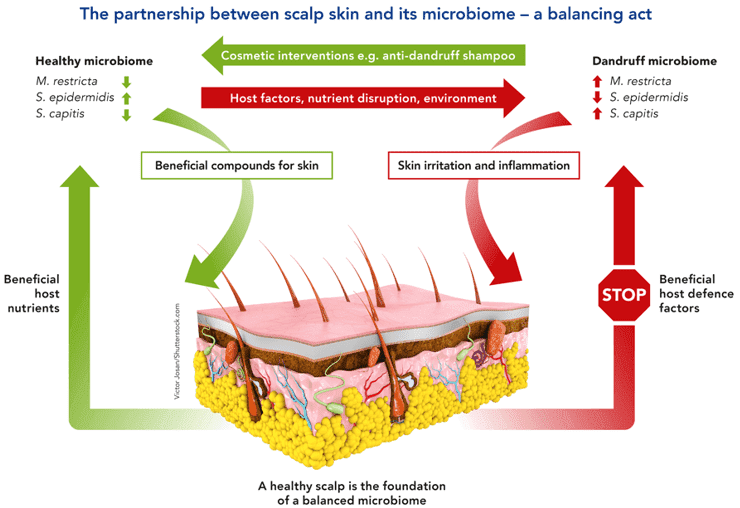 How to Study Scalp Microbiome: From Sampling to Sequencing to Analysis 