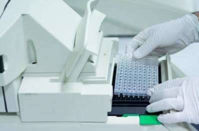 SYBR Green I-based qPCR Assay for ARGs