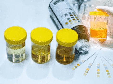 Urine Microbiome Research