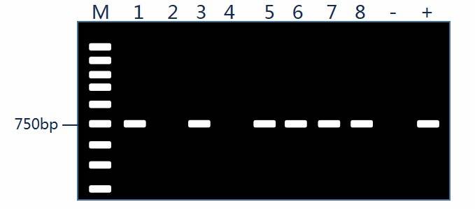 Verification of Recombinant Colonies via PCR 