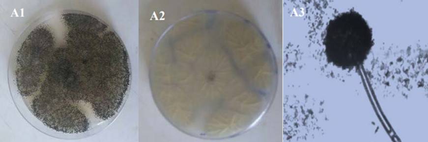 Aspergillums niger colony features on PDA (A1 Top, A2 Reverse) and conidia