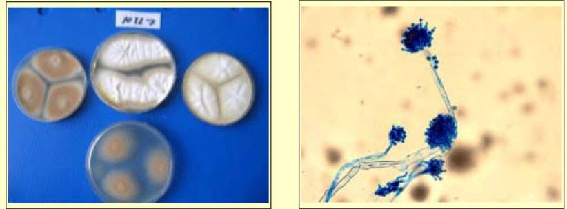 Colony feature of A. tereus in four differential media.