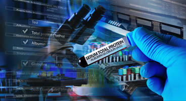 Microbial Transcriptomics