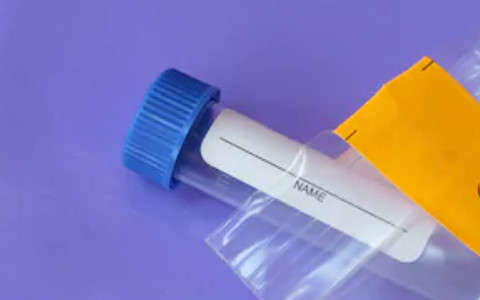 Saliva Sample Collection and Handling Instructions