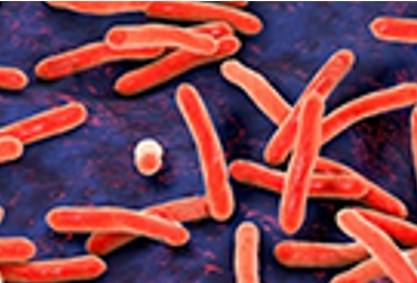 what-is-the-difference-between-aerobes-and-anaerobes-1